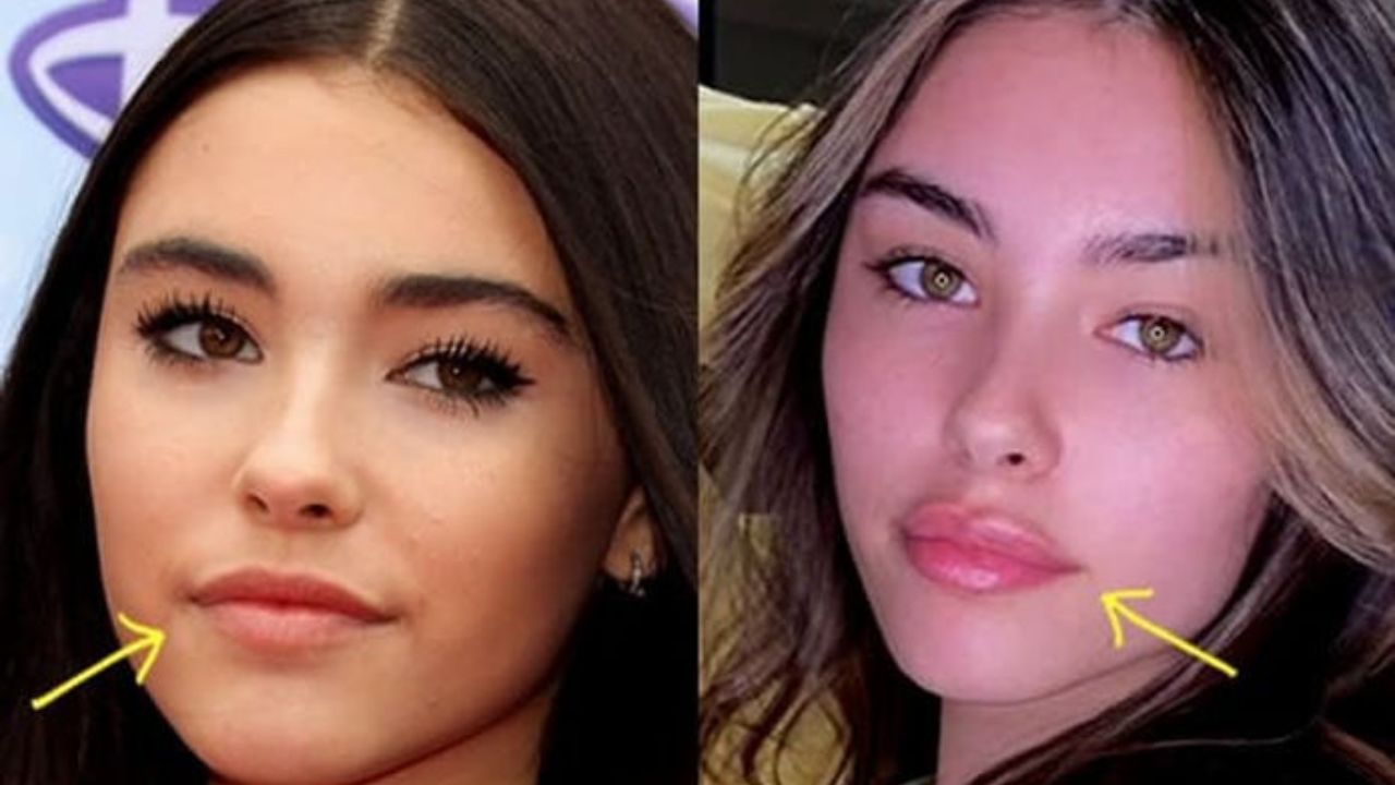 Madison Beer Before Surgery: What You Need To Know! Rallshe