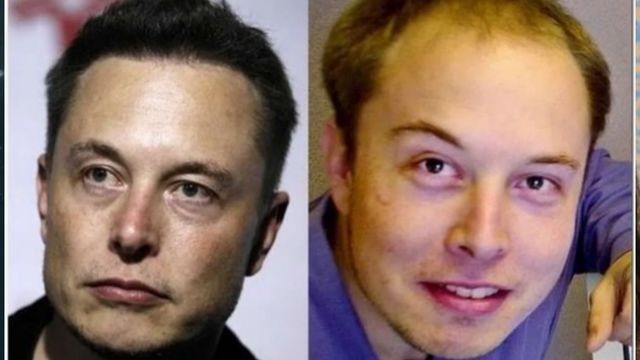 Elon Musk Plastic Surgery: Fact or Fiction?